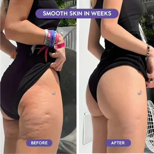Eleveia customer result